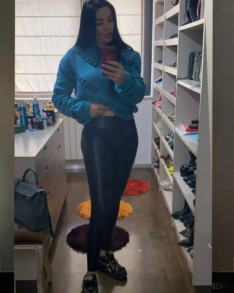 Brigitte-Pastramă-intervenție-estetică-față-2