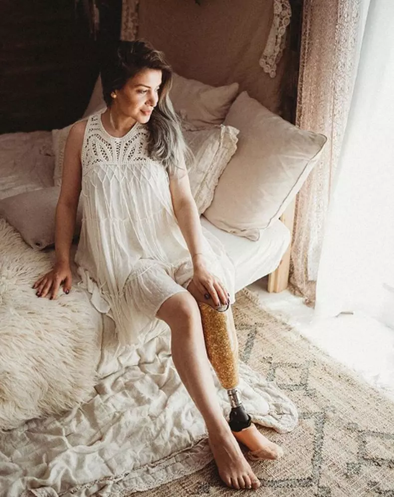 Stela Bizdu și-a pierdut piciorul în urma unui accident de mașină