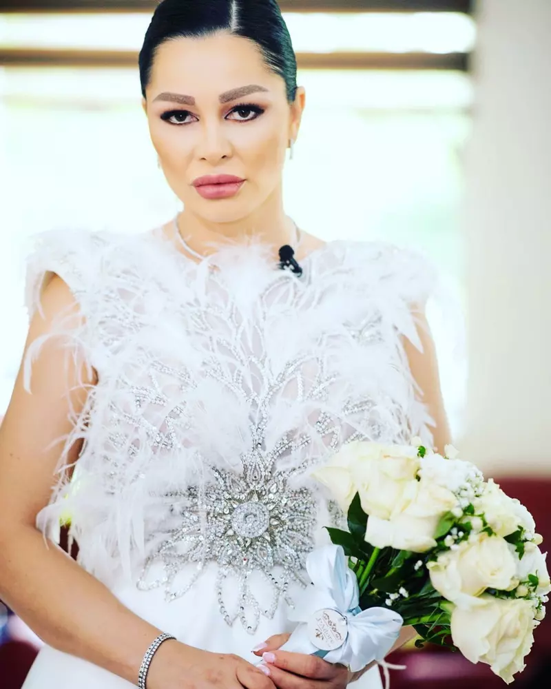Brigitte Sfăt Pastramă operații estetice