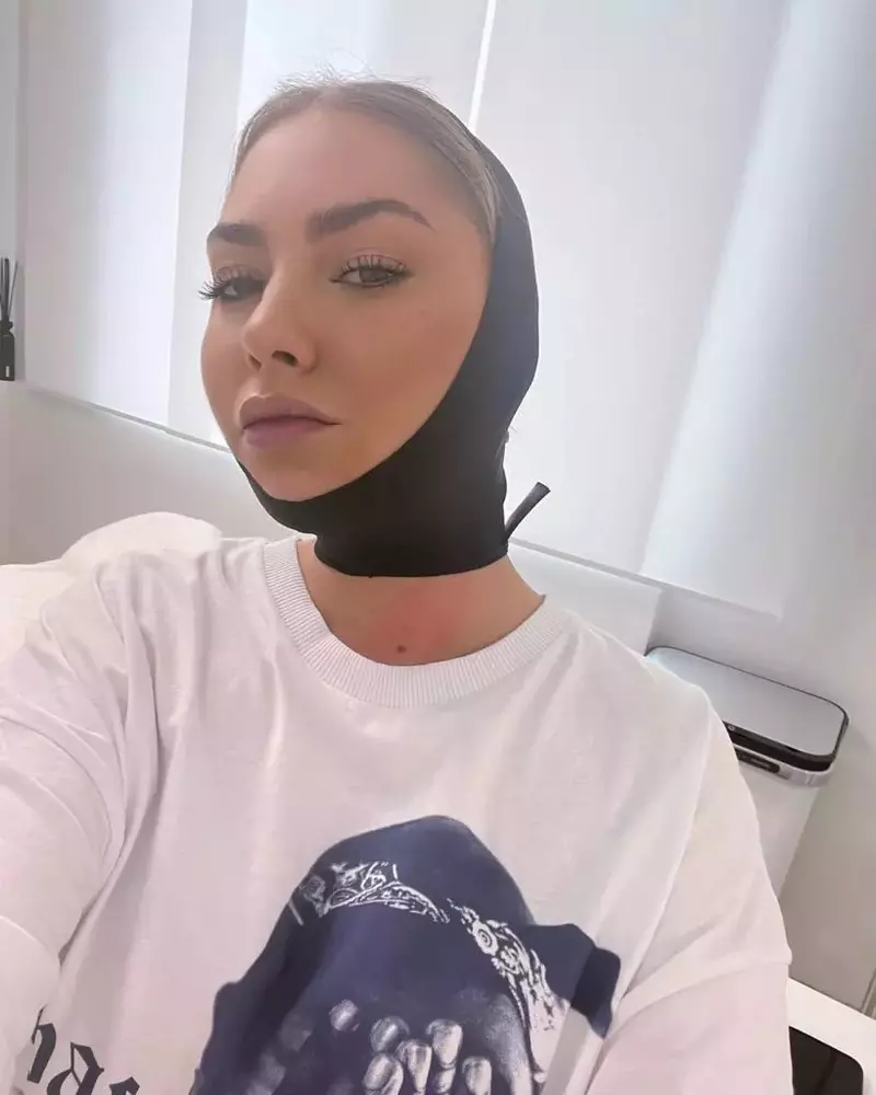 Ce operație estetică și-a făcut Jo „pentru sufletul ei”. Cum se recuperează acum artista