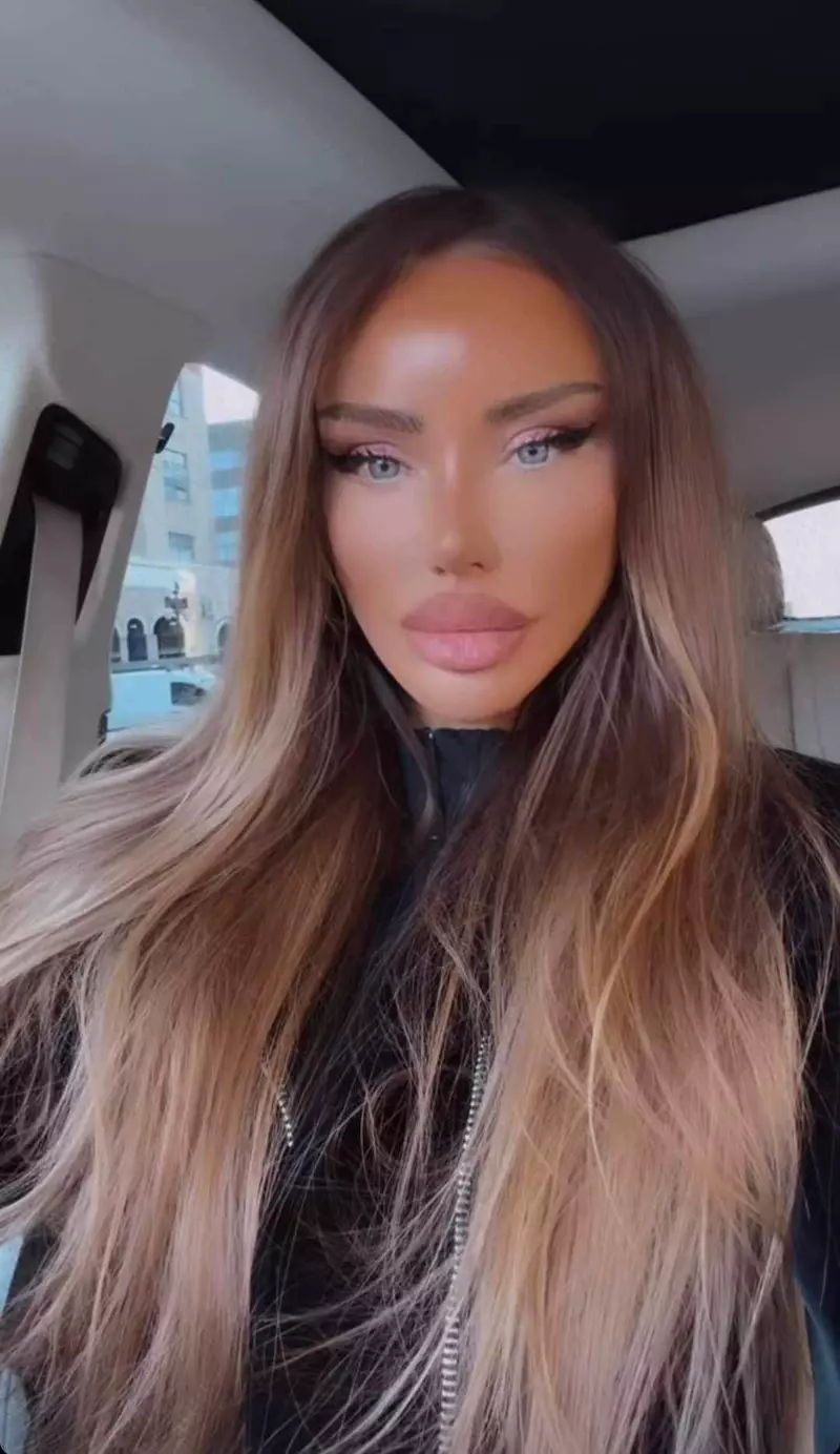 Bianca Drăgușanu rezultat lifting facial (2)