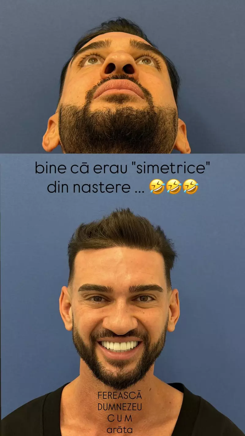 Dorian Popa înainte de operația la nas (2)