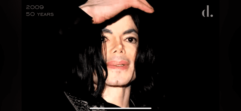 Michael Jackson, după operaţiile estetice