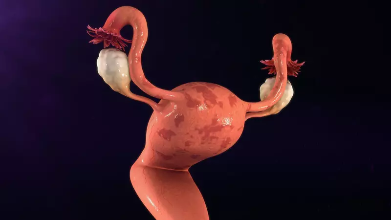 cancer de col uterin 4