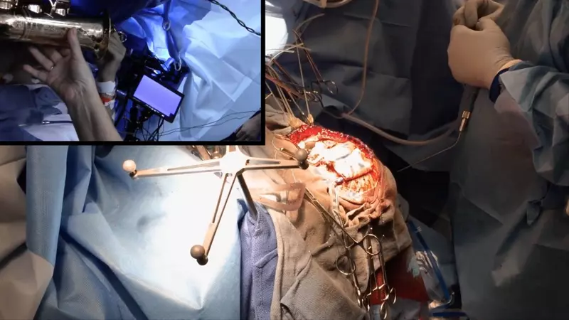 Musician plays sax during brain surgery to prove his skills are