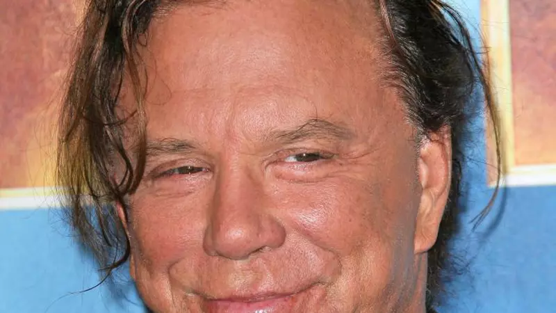 TOP 10 celebrități desfigurate de operațiile estetice