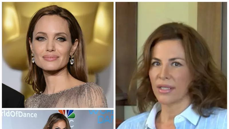 Adina Alberts, chirurgul estetician al vedetelor, dă verdictul: Ce operaţii au Angelina Jolie şi Jennifer Lopez