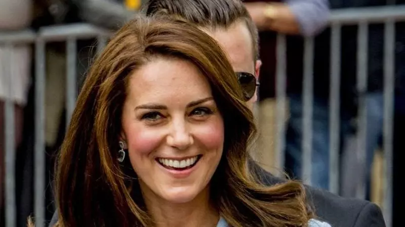 Adina Alberts, chirurg estetician, despre Ducesa de Cambridge: „Acidul hialuronic este cheia”