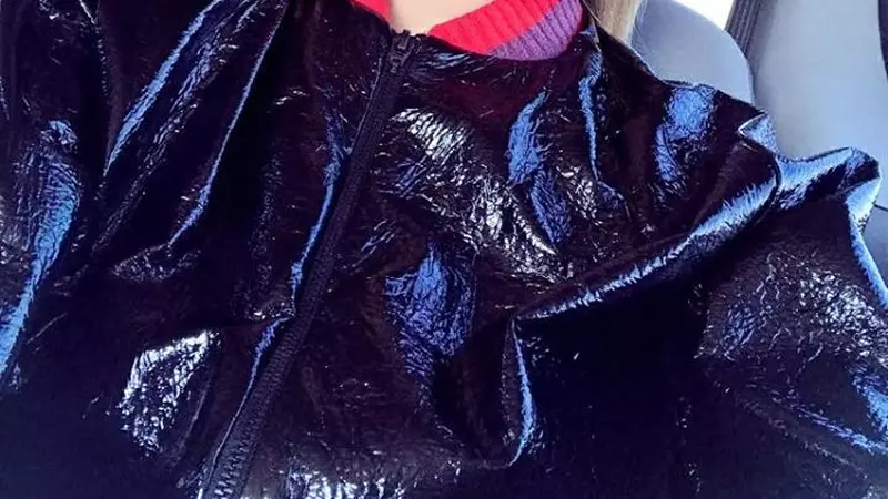 Adina Alberts, chirurg estetician, despre Lidia Buble şi nasul ei celebru