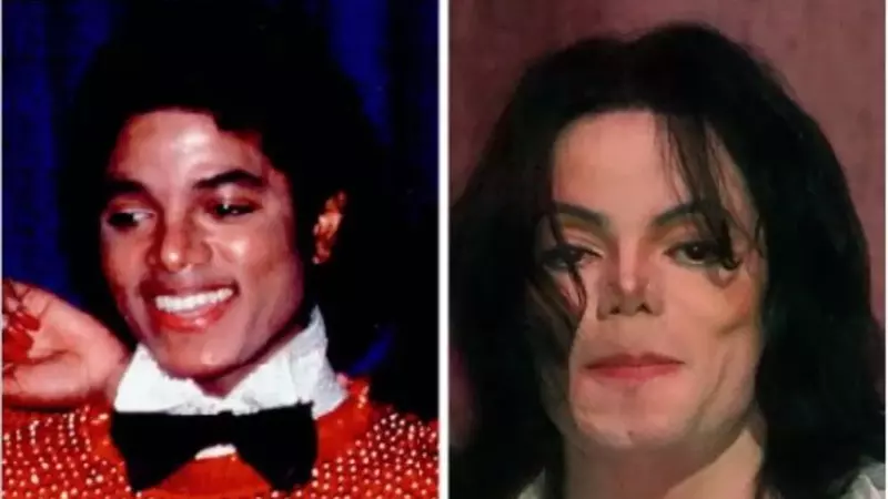 Top 10 celebrități desfigurate de operațiile estetice