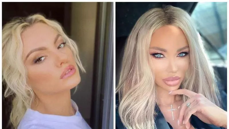 Vedete bătute și desfigurate de iubiți. Au trăit momente de groază și s-au ales cu traume pe viață