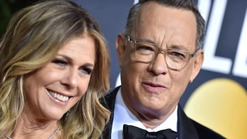 La o săptămână după anunțul că au coronavirus, Tom Hanks și soția lui au fost externați. Cuplul s-a retras în carantină la casa deținută în Australia