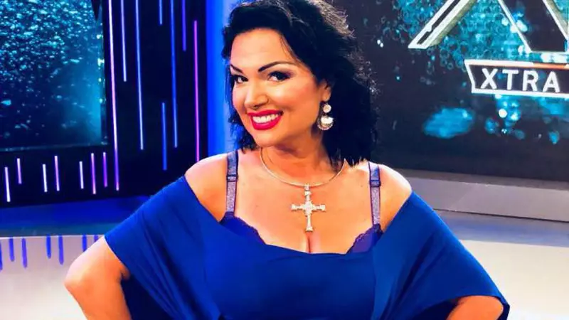 Ozana Barabancea, taxată de fani, după ce și-a modificat chipul, cu ajutorul aplicațiilor de pe telefon. Imaginile au stârnit controverse!