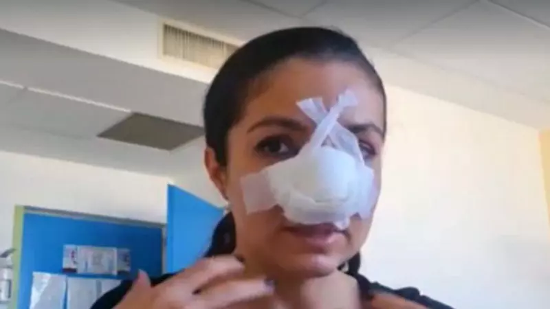 Cristina Joia, de la Visuri la Cheie, a făcut a doua operație la nas, după ce a fost bătută: „Intervenţia a durat cinci ore”