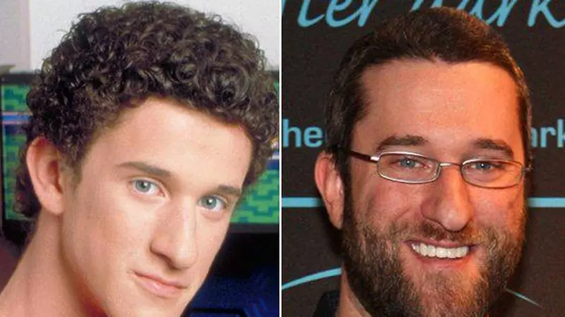 Dustin Diamond, Screech din Salvați de clopoțel, diagnosticat cu cancer în stadiul 4!