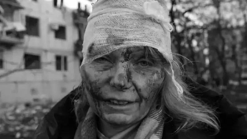 Femeia rănită din Ucraina, adevărul despre poza cu ea, devenită virală: „Totul este real. Iată bucățile de sticlă care au rămas în mine”
