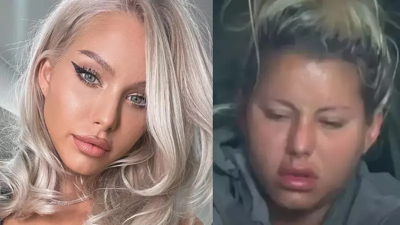 Carmen Grebenișan a apărut cu fața umflată, după trei luni la Survivor 2023: "Apar afecțiuni, boli legate de..."