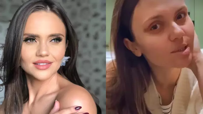 Cristina Șișcanu a apărut cu ochiul vânăt pe Instagram: "Nu vă imaginați ce durere a fost"