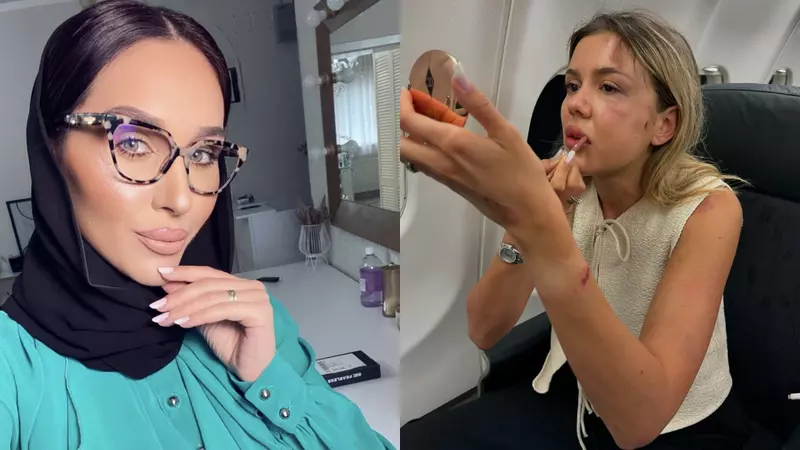 Dana Roba, reacție acidă după ce a văzut-o pe Emily Burghelea că își retușa machiajul în urma accidentului suferit: „Mi se pare penibil. Tu îți faci poze și te rujezi..."