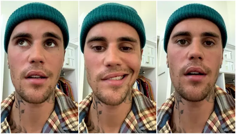 Justin Bieber față paralizată