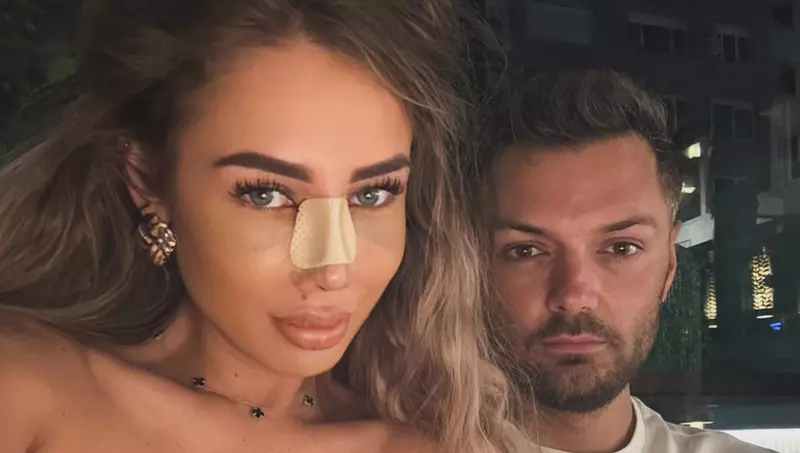 Cum arată Maria Avram de la Insula Iubirii 2025 după operația de rinoplastie