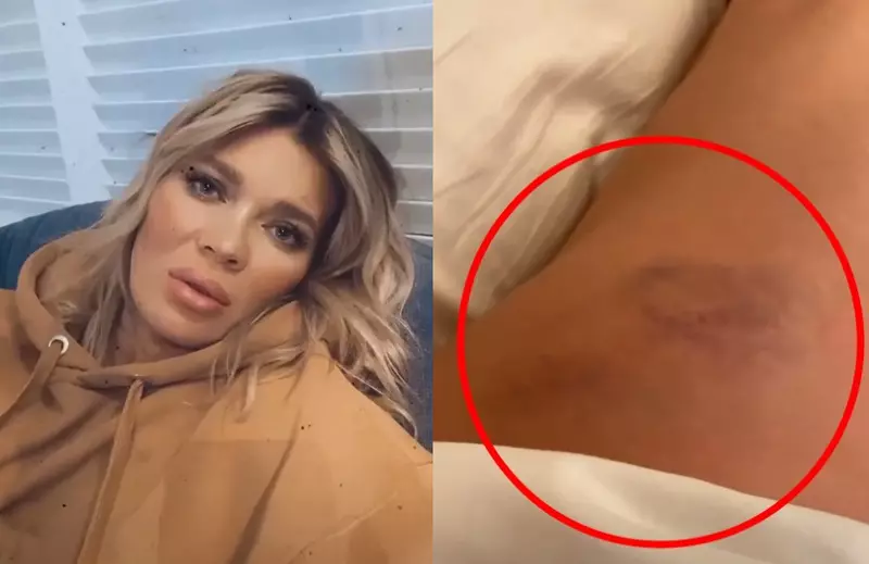 gina accident