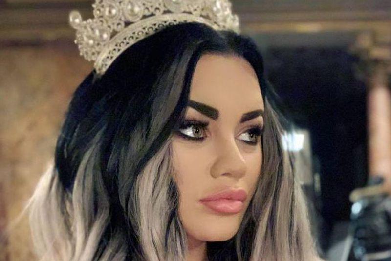 Cum Arăta Carmen De La Sălciua Inainte De Operațiile Estetice