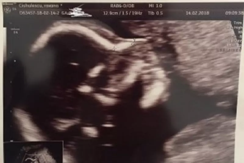 Roxana Ciuhulescu, Ana Cleopatra şi Silviu