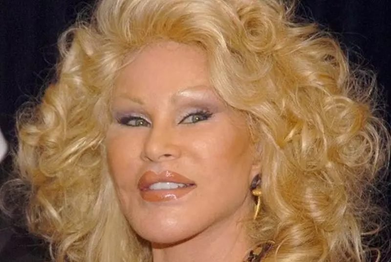 Jocelyn Wildenstein a fost o femeie drăguță.