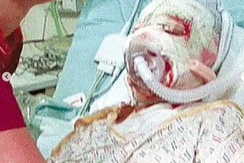 cum-arata-katie-piper-la-12-ani-dupa-ce-chipul-i-a-fost-distrus-cu-acid-sulfuric_6