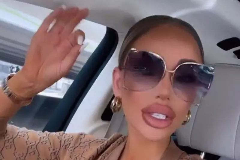 bianca dragusanu si-a schimbat forma buzelor