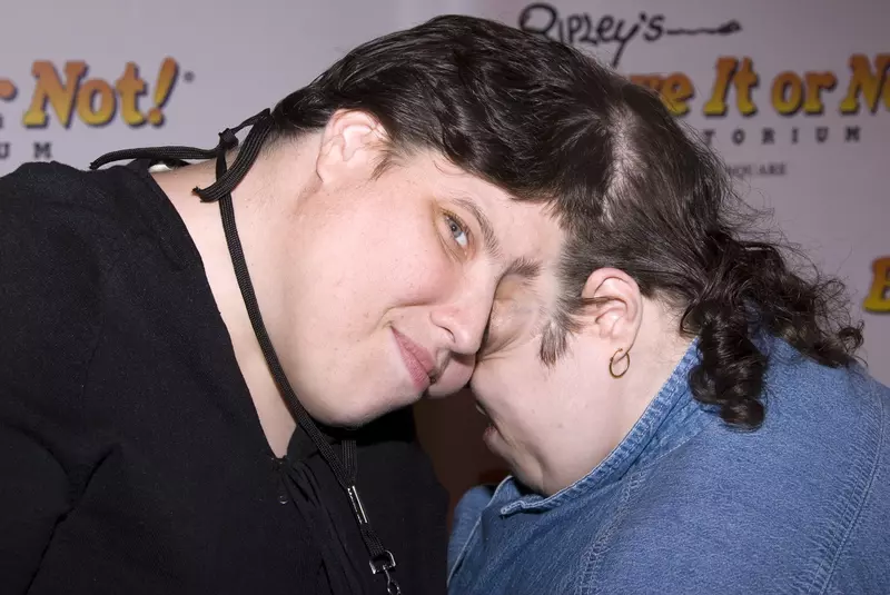 The World’s Oldest Conjoined Twins at the official opening of „Ripley’s Believe It Or Not Odditorium” in New York