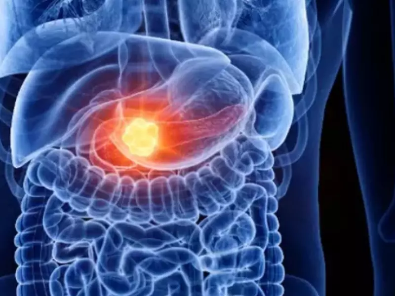 Ce au descoperit specialiștii despre cancerul pancreatic, unul dintre cele mai răspândite tipuri de cancer