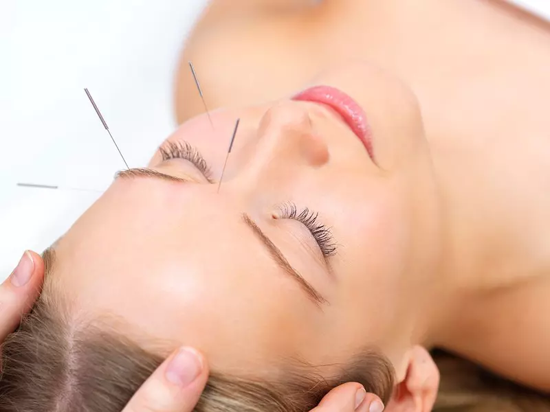 (P) Acupunctura București cel mai bun cabinet de acupunctură