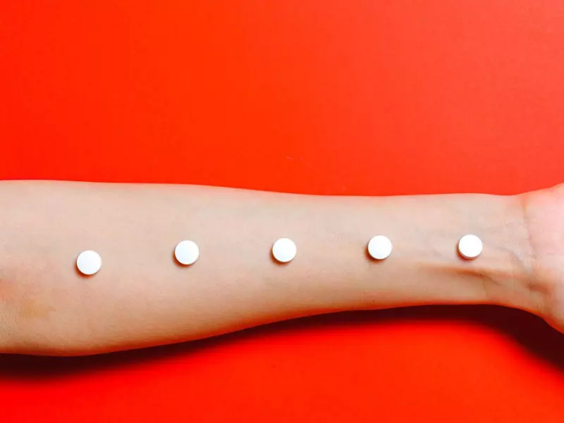 De ce apare urticaria și cum putem ameliora simptomele acesteia?