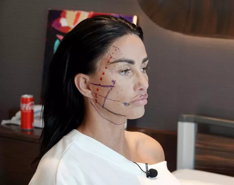 *PREMIUM-EXCLUSIVE* MUST CALL FOR PRICING BEFORE USAGE  - After an arrest warrant has been issued for her bankruptcy misdemeanours, Katie Price is pictured out in Turkey where the star is set to go under the knife for possible facial surgery as she visits