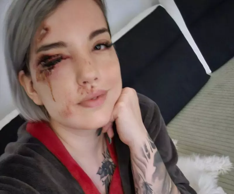 Influencerița Iulia Cristina a apărut cu fața desfigurată pe Instagram (2)