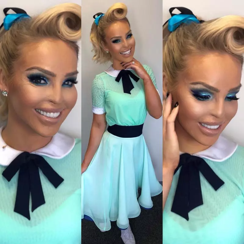 Katie Piper acid
