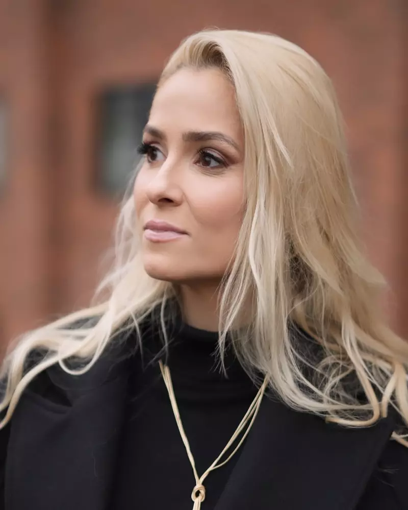 Elena Vîșcu, intervenție estetica la un an de la divorțul de CRBL (1)