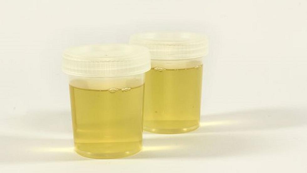 tratament de urină articulară