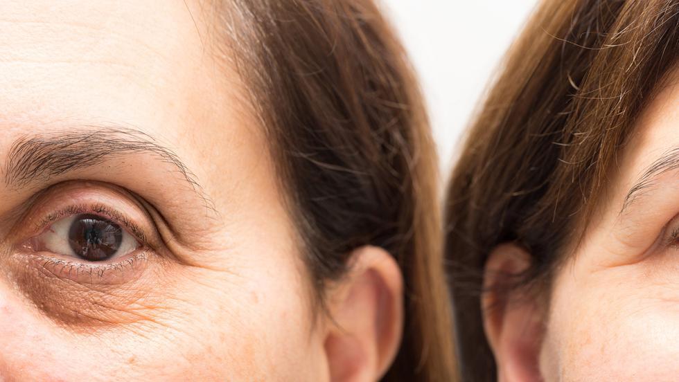 masca pentru netezirea ridurilor de sub ochi produse naturale de îngrijire a pielii anti-îmbătrânire