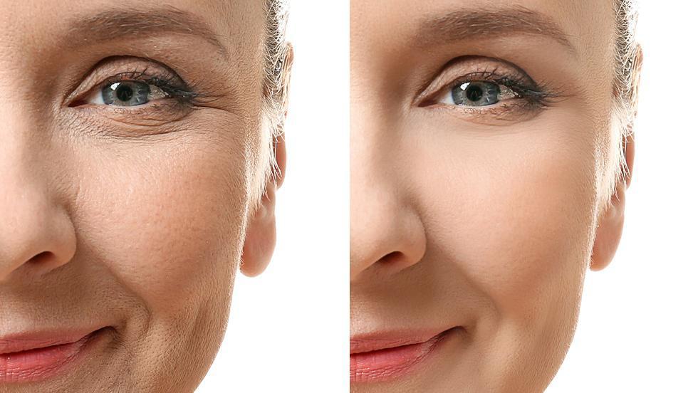 cum să-ți păstrezi fața fără riduri crema elmiplant detox