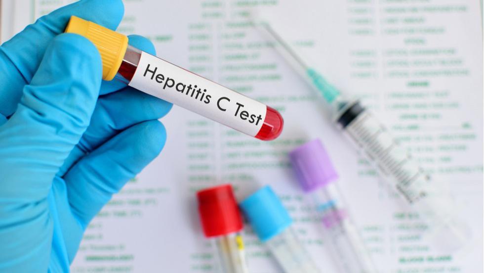 Tot Ce Trebuie Să știi Despre Hepatita C Cum Se Transmite Virusul și Ce Trebuie Să Faci Pentru A Preveni Această Afecțiune Sanatate Avantaje Ro De 20 De Ani Pretuieste