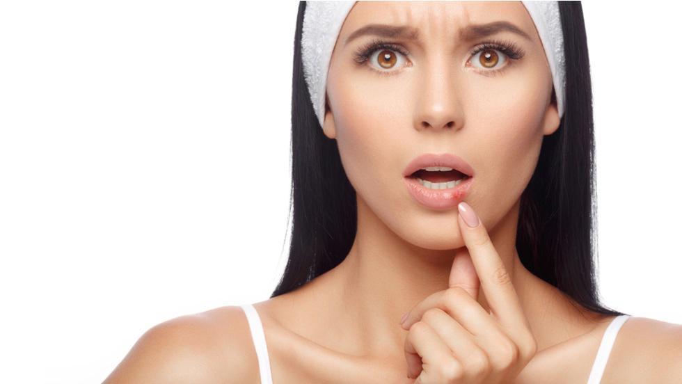 Simptomele Herpesului Care Nu Trebuie Neglijate Cum Pot Fi Confundate Cu O SimplÄƒ RÄƒcealÄƒ Sanatate Avantaje Ro De 20 De Ani Pretuieste Femei Ca Tine